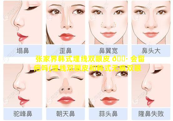 张家界韩式埋线双眼皮 🌷 会留疤吗(埋线双眼皮和韩式无痕双眼皮有 🐬 什么区别)